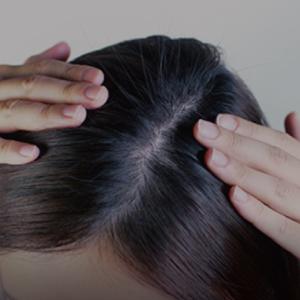 2/將頭髮撥開，讓頭皮露出。