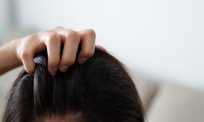 頭皮出現紅斑性狼瘡症狀？別怕，這樣處理最安心