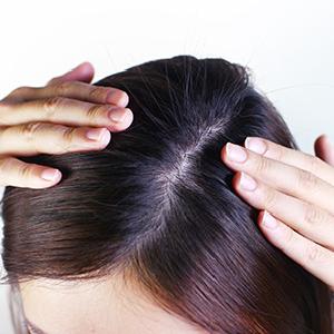 2/將頭髮撥開,讓頭皮露出。