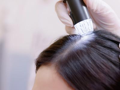 頭皮檢測及護理真的靠譜嗎?