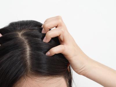 為什麼總是頭皮發癢?該如何改善?
